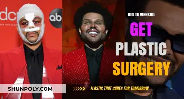 Did The Weeknd Undergo Plastic Surgery? Unveiling the Truth Behind His Look