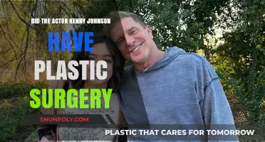 Kenny Johnson's Transformation: Plastic Surgery Rumors Explored