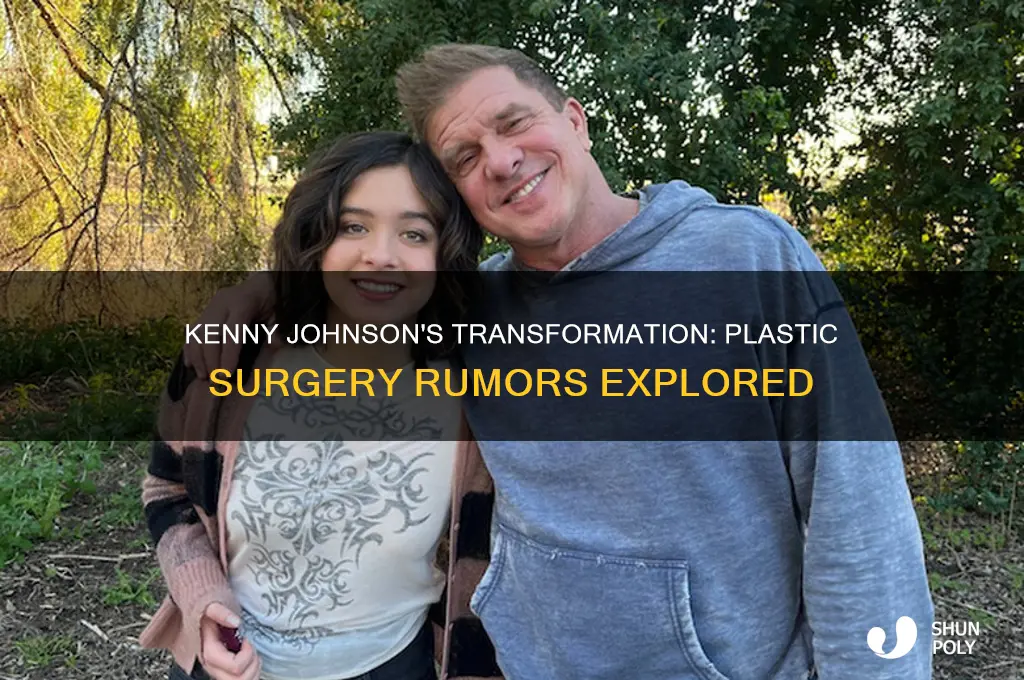 did the actor kenny johnson have plastic surgery