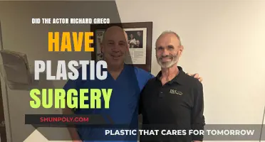 Richard Greco's Transformation: Plastic Surgery Rumors Explored