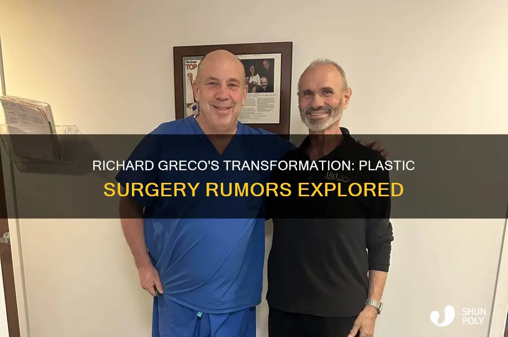 did the actor richard greco have plastic surgery