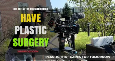 Richard Grieco's Transformation: Plastic Surgery Rumors Explored