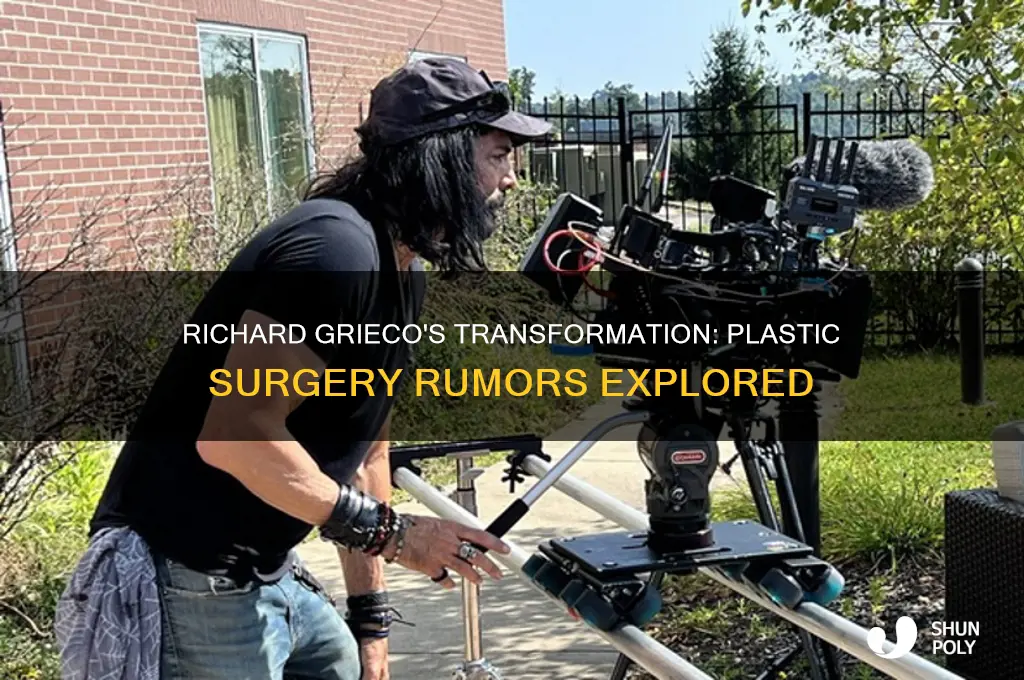 did the actor richard grieco have plastic surgery