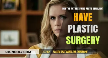 Did Starlight's Actress Erin Moriarty Undergo Plastic Surgery?