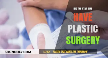 Did AT&T Girl Have Plastic Surgery? Unveiling the Truth