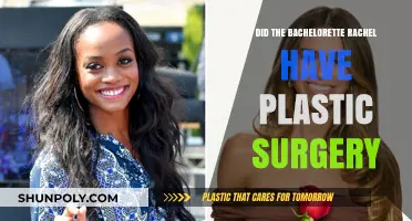 Rachel Lindsay's Transformation: Plastic Surgery Rumors Explored