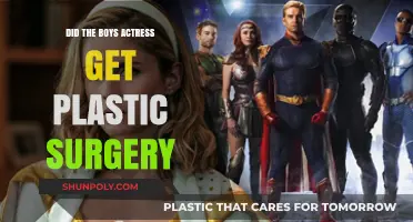 Did The Boys Actress Undergo Plastic Surgery? Unveiling the Truth