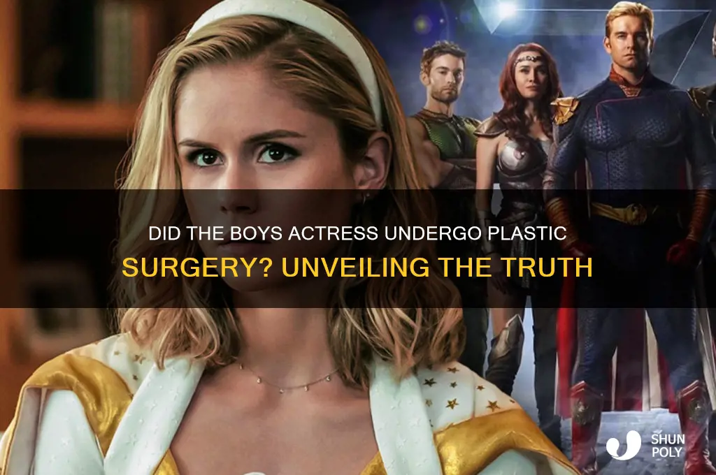 did the boys actress get plastic surgery