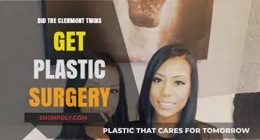 Clermont Twins Plastic Surgery: Fact or Fiction? Unveiling the Truth
