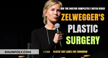Renee Zellweger's Plastic Surgery: Did the Doctor Botch It?