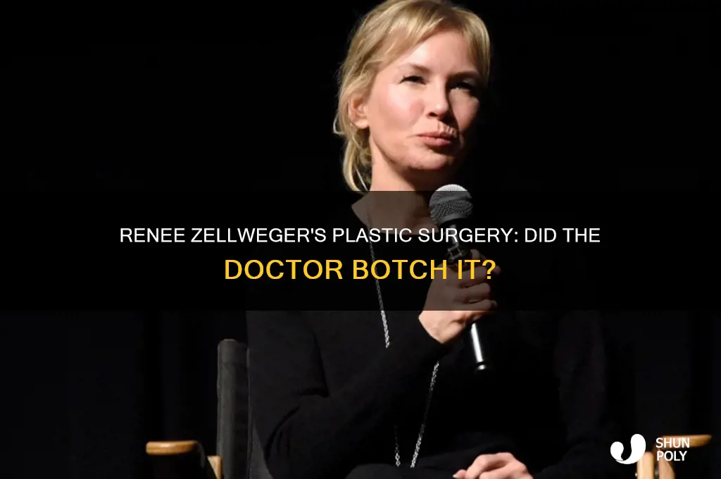 did the doctor completely botch renee zelwegger
