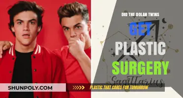 Did the Dolan Twins Undergo Plastic Surgery? Unveiling the Truth