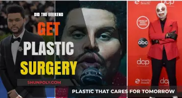 Did The Weeknd Undergo Plastic Surgery? Unveiling the Truth Behind His Look