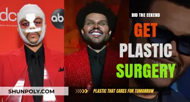 Did The Weeknd Undergo Plastic Surgery? Uncovering the Truth Behind His Look