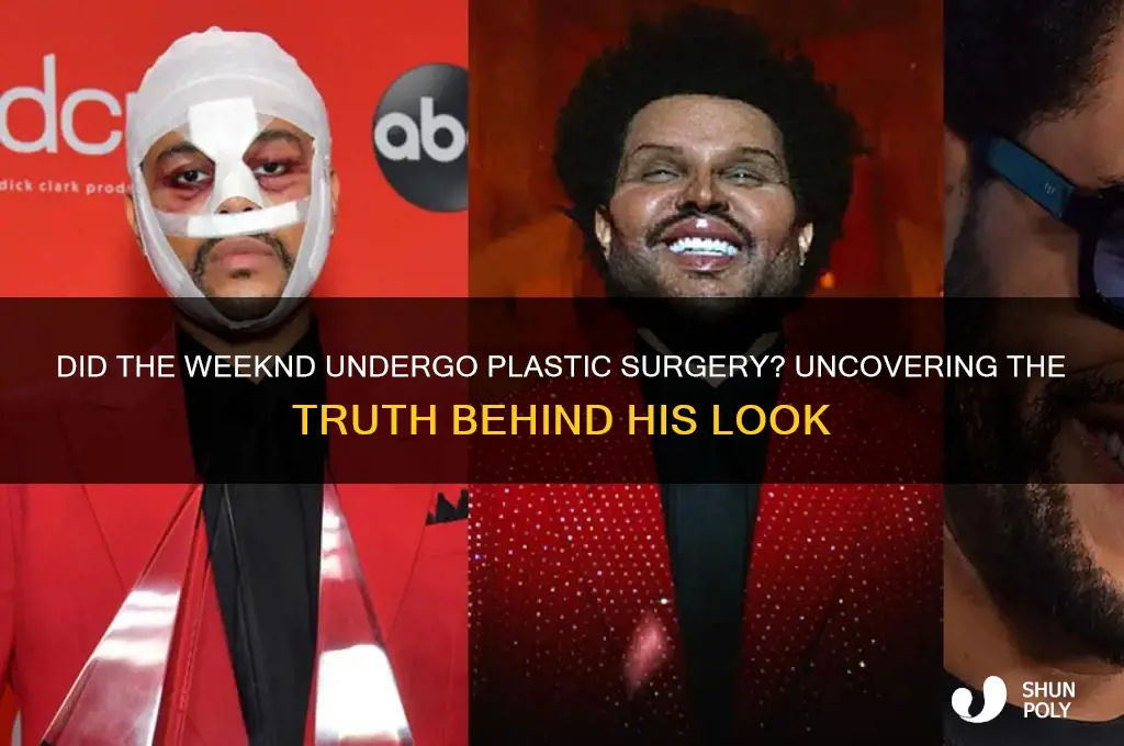 did the eekend get plastic surgery