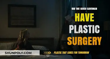 Did the GEICO Caveman Undergo Plastic Surgery? Unveiling the Truth