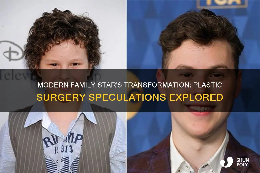 did the girl from modern family have plastic surgery