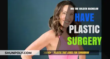 The Golden Bachelor's Transformation: Plastic Surgery Speculations Explored
