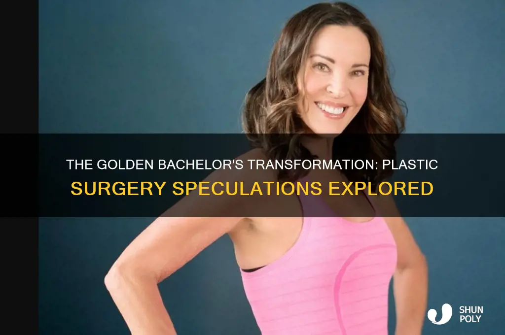 did the golden bachelor have plastic surgery
