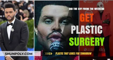 Did The Weeknd Undergo Plastic Surgery? Unraveling the Transformation Rumors