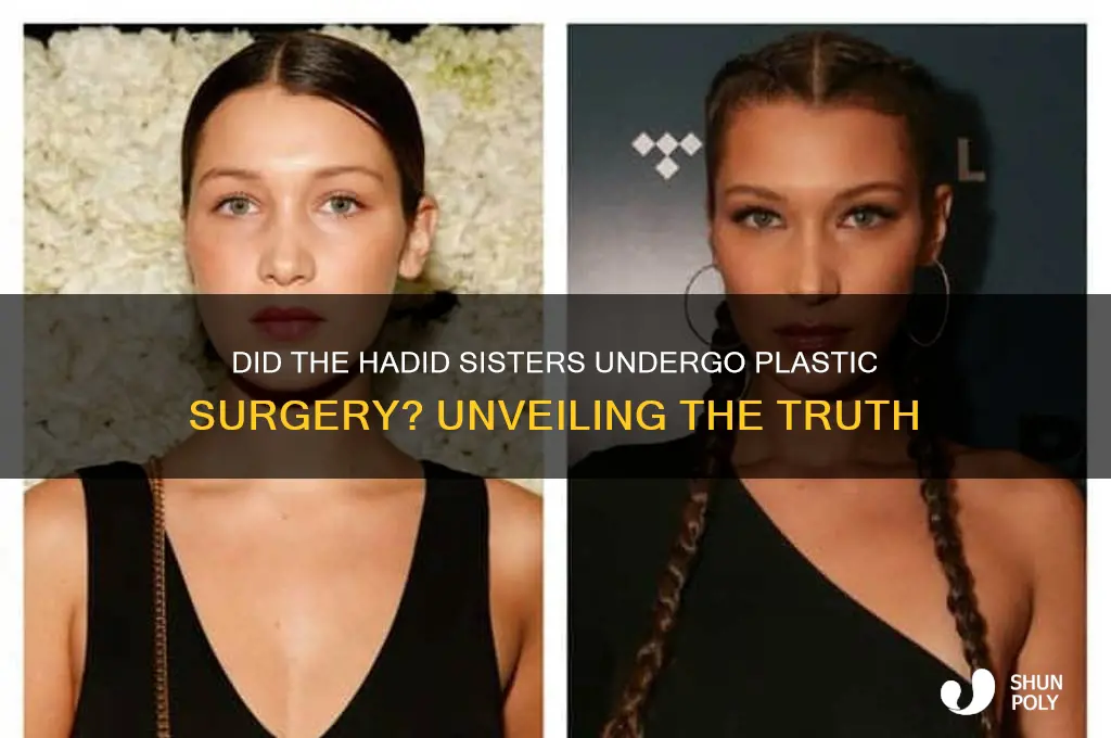 did the hadid sisters have plastic surgery