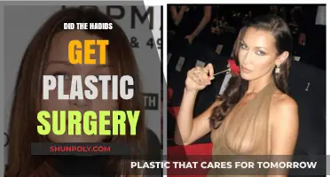 Did the Hadids Undergo Plastic Surgery? Unveiling the Truth