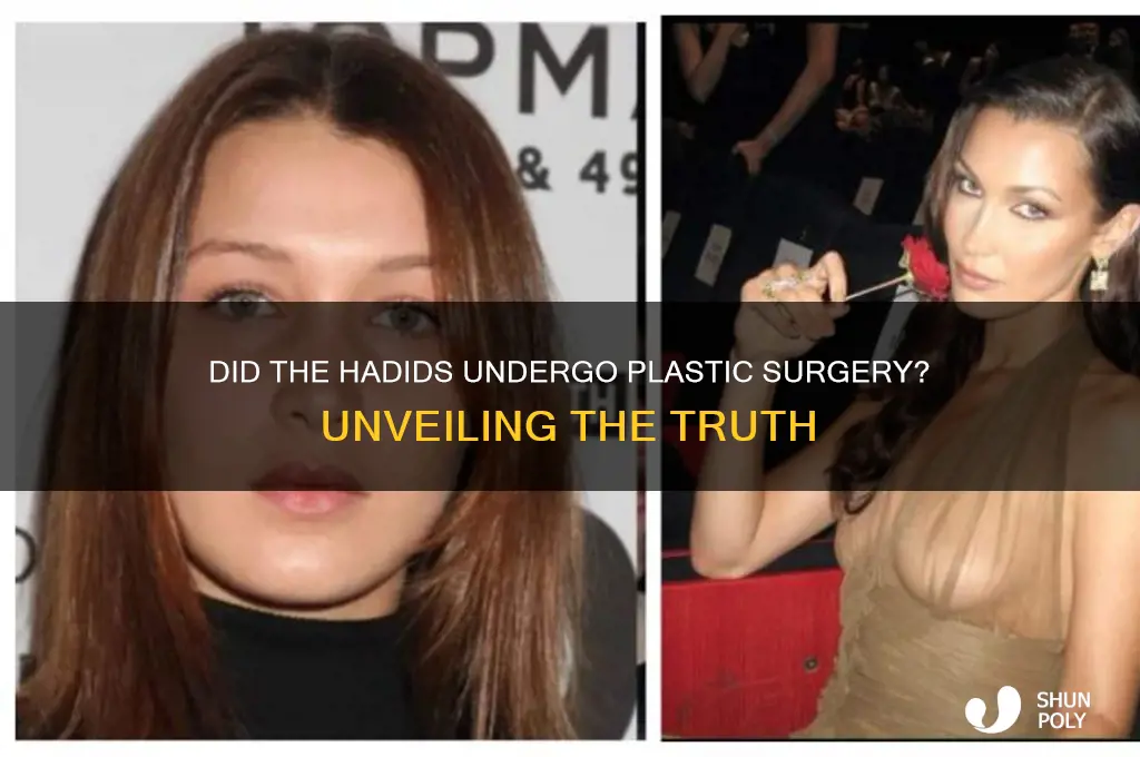 did the hadids get plastic surgery