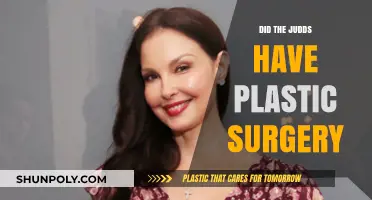 Did The Judds Undergo Plastic Surgery? Unveiling the Truth
