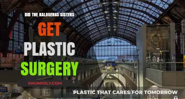 Kalogeras Sisters Plastic Surgery: Fact-Checking the Transformation Rumors