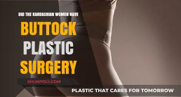Kardashian Women and the Buttock Plastic Surgery Speculation
