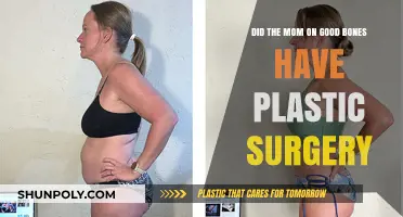 Good Bones Star's Transformation: Did Mom Undergo Plastic Surgery?