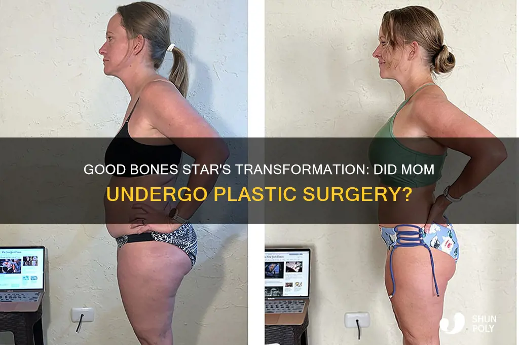 did the mom on good bones have plastic surgery