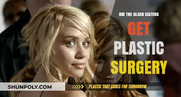 Olsen Twins Plastic Surgery: Fact or Fiction? Unveiling the Truth