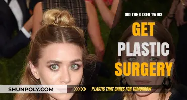 Olsen Twins Plastic Surgery: Fact or Fiction? Unveiling the Truth