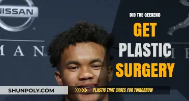 Did The Weeknd Undergo Plastic Surgery? Unraveling the Transformation Speculations