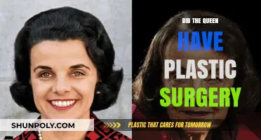 Did Queen Elizabeth II Undergo Plastic Surgery? Unveiling Royal Secrets