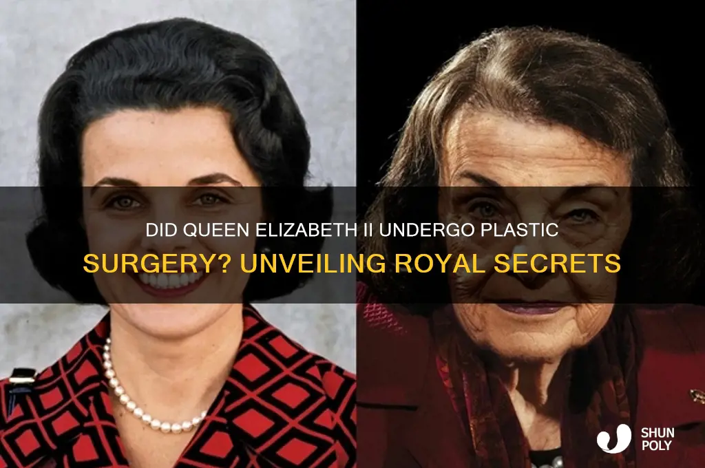 did the queen have plastic surgery