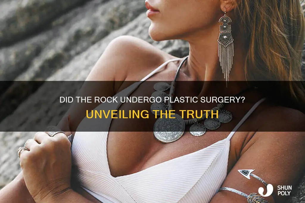 did the rock get plastic surgery