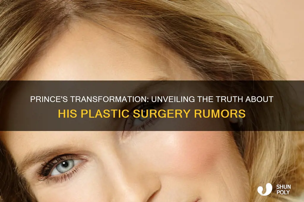 did the singer prince have plastic surgery