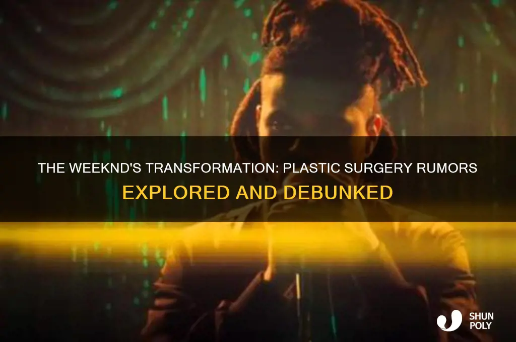 did the singer the weeknd get plastic surgery