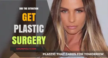 Did The Situation Get Plastic Surgery? Unveiling the Truth Behind His Transformation