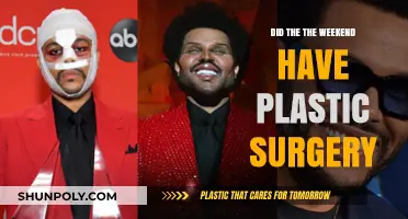 The Weeknd's Transformation: Plastic Surgery Rumors Explored and Debated