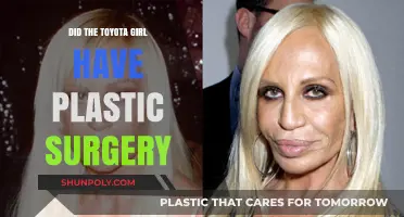 Toyota Girl's Transformation: Plastic Surgery Rumors Explored and Debunked