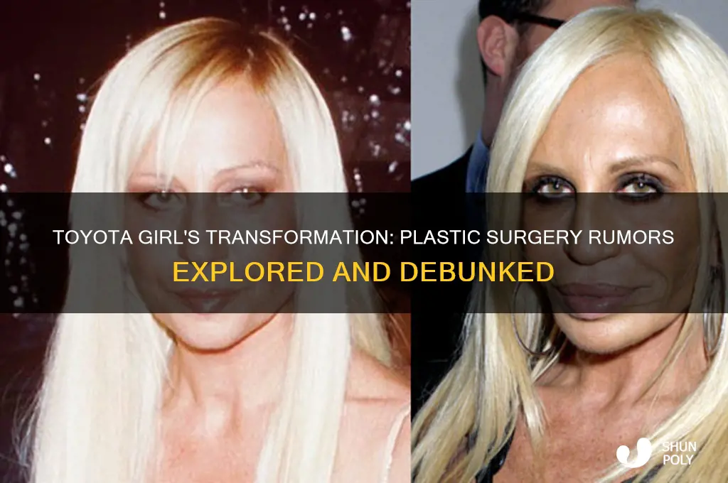 did the toyota girl have plastic surgery