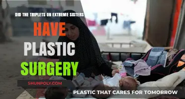 Extreme Sisters Triplets: Plastic Surgery Rumors and Transformations Explored