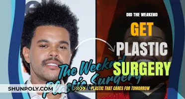 Did The Weeknd Undergo Plastic Surgery? Unraveling the Transformation Rumors