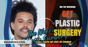 Did The Weeknd Undergo Plastic Surgery? Unraveling the Transformation Rumors