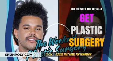 Did The Weeknd Undergo Plastic Surgery? Unveiling the Truth Behind the Rumors