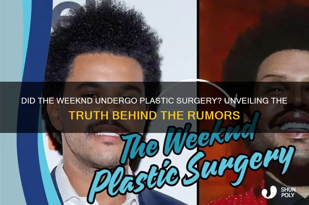 did the week and actually get plastic surgery
