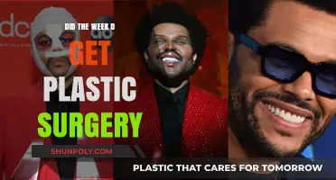 Did Weeknd Undergo Plastic Surgery? Unraveling the Truth Behind His Look